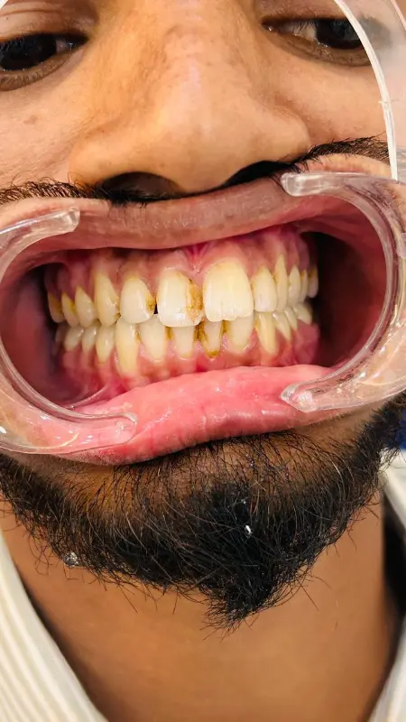 Advanced dental equipment